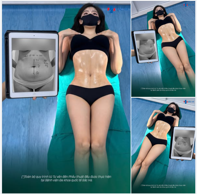 ĐỪNG CHỈ NHÌN VÀO VÒNG EO — HÃY NHÌN CẢ DÁNG BODY
