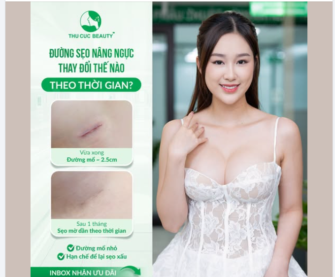 MUỐN NÂNG NGỰC NHƯNG SỢ SẸO XẤU?