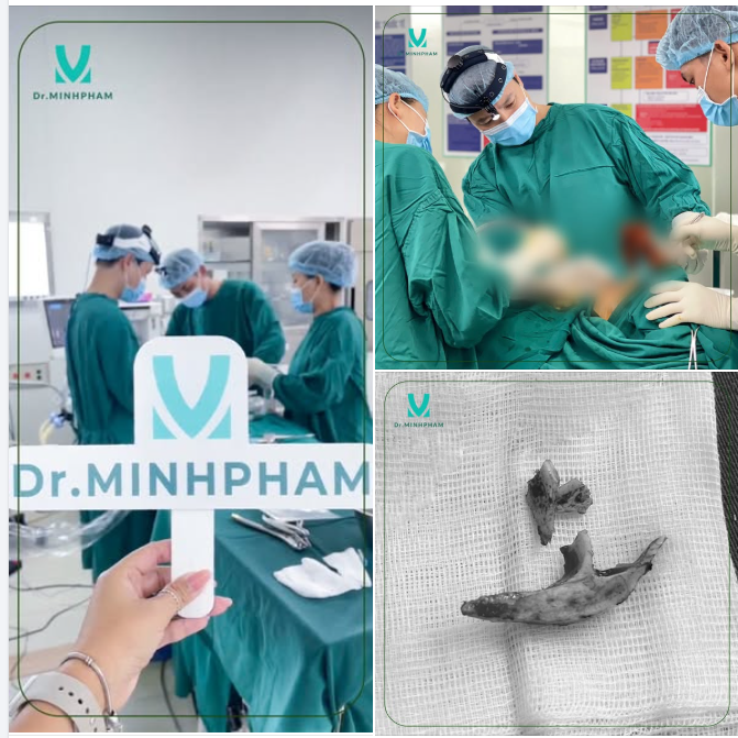 TẠM BIỆT GƯƠNG MẶT GÓC CẠNH