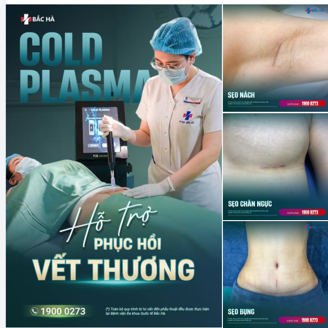 ĐỪNG CHỈ HỎI PHẪU THUẬT Ở ĐÂU ĐẸP..