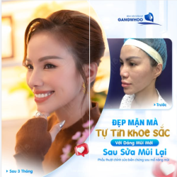 ĐẸP MẶN MÀ - TỰT TIN KHOE SẮC