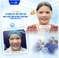 TRẺ HÓA TỪ ĐƯỜNG NÉT ĐẾN THẦN THÁI