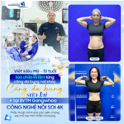 SỬA CHỮA LỖI LẦM TỪNG CĂNG DA BỤNG NƠI KHÁC
