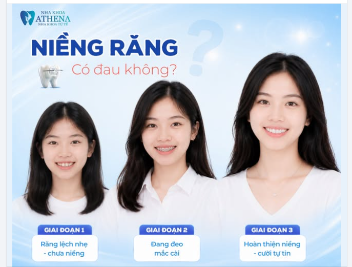 SỰ THẬT TỪ NGƯỜI TRONG CUỘC: NIỀNG RĂNG CÓ ĐAU NHƯ LỜI ĐỒN?