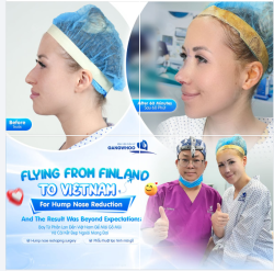 Hành trình từ Phần Lan đến Việt Nam không chỉ là một chuyến đi, mà còn là hành trình tìm kiếm sự tự tin với diện mạo mới.