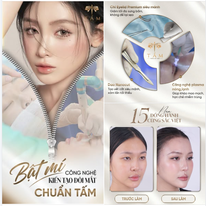 BẬT MÍ CÔNG NGHỆ KIẾN TẠO ĐÔI MẮT "CHUẨN TẤM" – ĐẸP TỰ NHIÊN, KHÔNG NGẠI SƯNG BẦM!