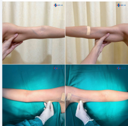 CÁNH TAY GỌN HƠN – MẶC GÌ CŨNG TỰ TIN HƠN