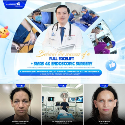 ĐẰNG SAU 1 CA TRẺ HÓA THÀNH CÔNG KHÔNG THỂ THIẾU ĐỘI NGŨ EKIP CHUYÊN NGHIỆP