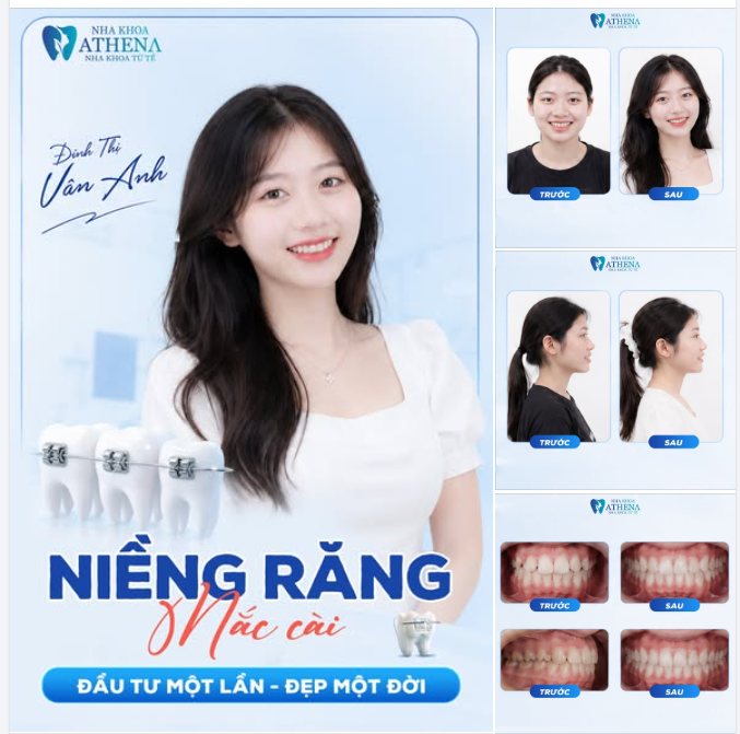 BÙNG NỔ NHAN SẮC - MÀN "LỘT XÁC" ĐỈNH CAO SAU KHI THÁO NIỀNG
