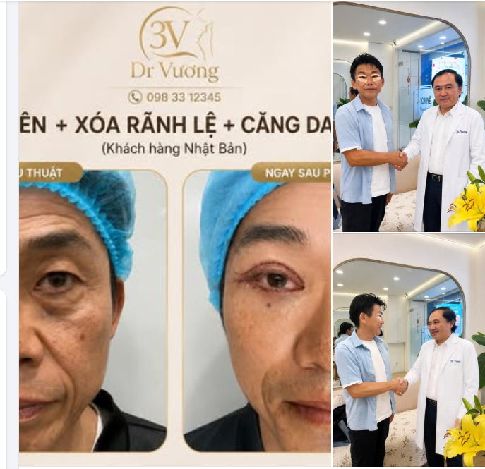 Ngài khách thẩm mỹ người Nhật Bản sang Việt Nam để trẻ hoá khuôn mặt với Bs Vương :