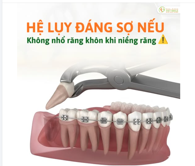 RĂNG SỐ 8 – “TRÙM CUỐI” PHÁ HỎNG KẾT QUẢ NIỀNG RĂNG MÀ NHIỀU NGƯỜI KHÔNG BIẾT
