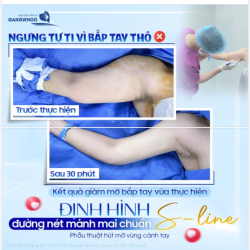 TỰ TIN DIỆN ĐỦ KIỂU ĐẦM DÂY XINH XẮN