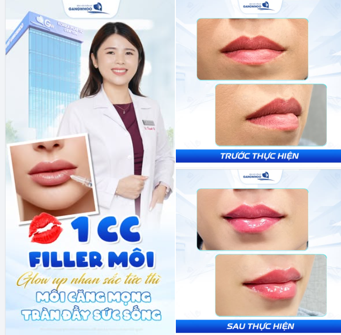 1 CC FILLER – CHẠM LÀ MÊ, MÊ LÀ YÊU!