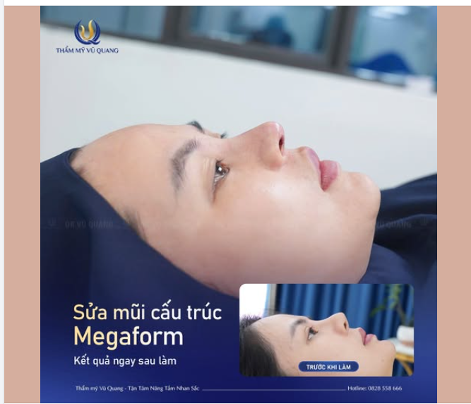 TẠM BIỆT DÁNG MŨI LỆCH – HỒI SINH NHAN SẮC SAU 60 PHÚT
