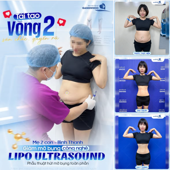 TÌM LẠI VÓC DÁNG THANH XUÂN: CÂU CHUYỆN TỪ NGƯỜI MẸ 2 CON TẠI BÌNH THẠNH