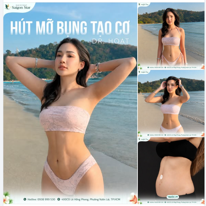 MÙA HÈ ĐẾN RỒI, ĐÃ SẴN SÀNG DIỆN BIKINI CHƯA?