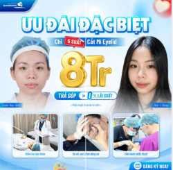 5 SUẤT CẮT MÍ EYELID VỚI ƯU ĐÃI SIÊU HOT