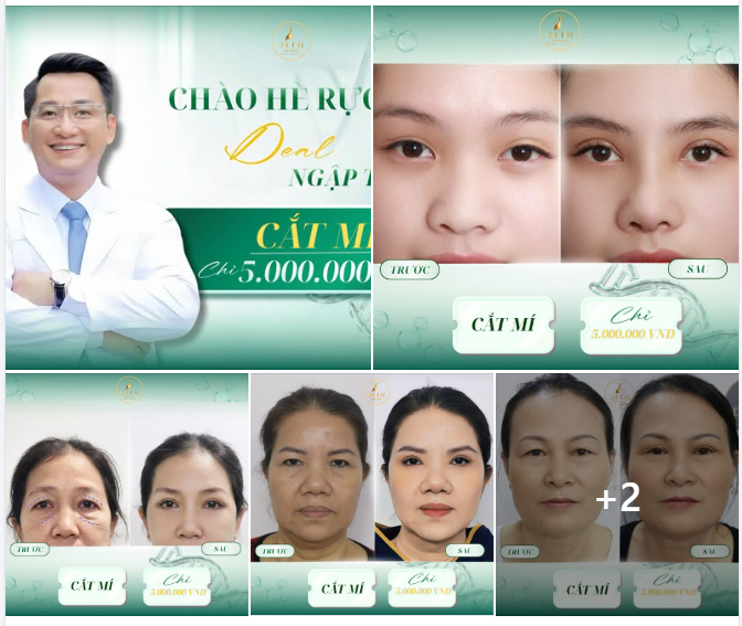 CHỈ VỚI 5.000.000VNĐ SỞ HỮU NGAY ĐÔI MẮT VẠN NGƯỜI MÊ