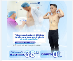 ANH KHÁCH TÌM LẠI PHONG ĐỘ  Sau giảm mỡ bụng tân trang vóc dáng tại Gangwhoo