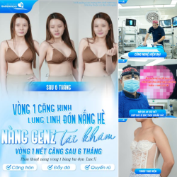VÒNG 1 CĂNG XINH, LUNG LINH ĐÓN NẮNG HÈ - NÀNG GENZ TÁI KHÁM VÒNG 1 NÉT CĂNG SAU 6 THÁNG