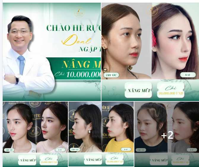 ƯU ĐÃI CHÀO HÈ: TRỌN GÓI NÂNG MŨI CHỈ 10.000.000 VNĐ