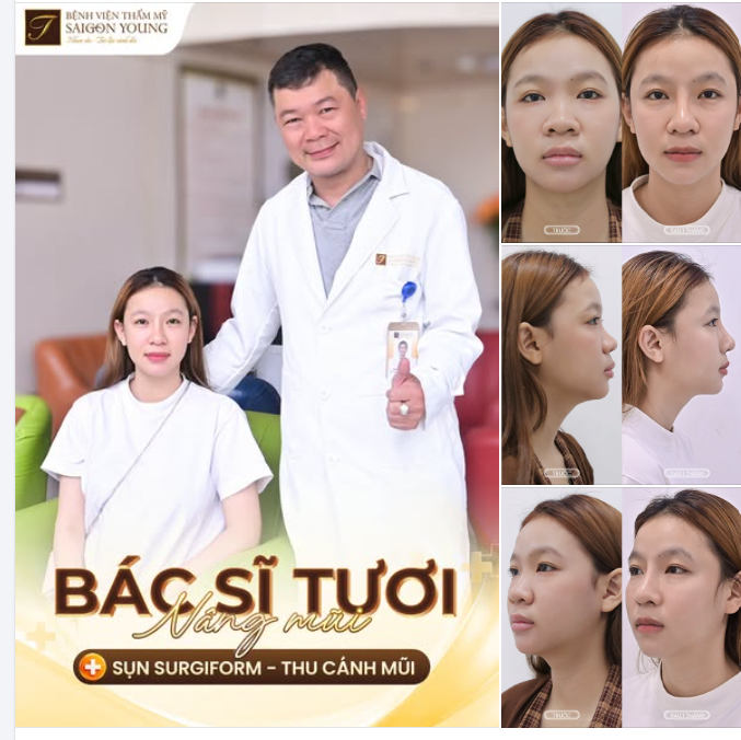 THAY ĐỔI DÁNG MŨI KHÁC BIỆT CÙNG BÁC SĨ TƯƠI