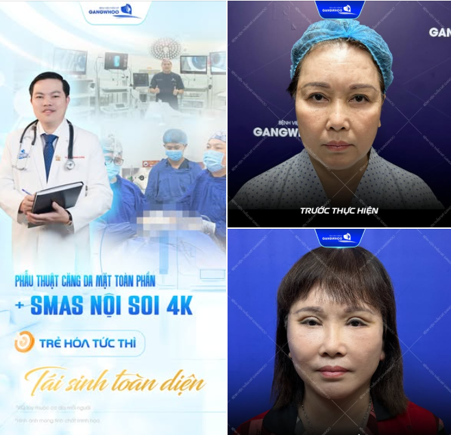 TRẺ HÓA TỨC THÌ - TÁI SINH DIỆN MẠO