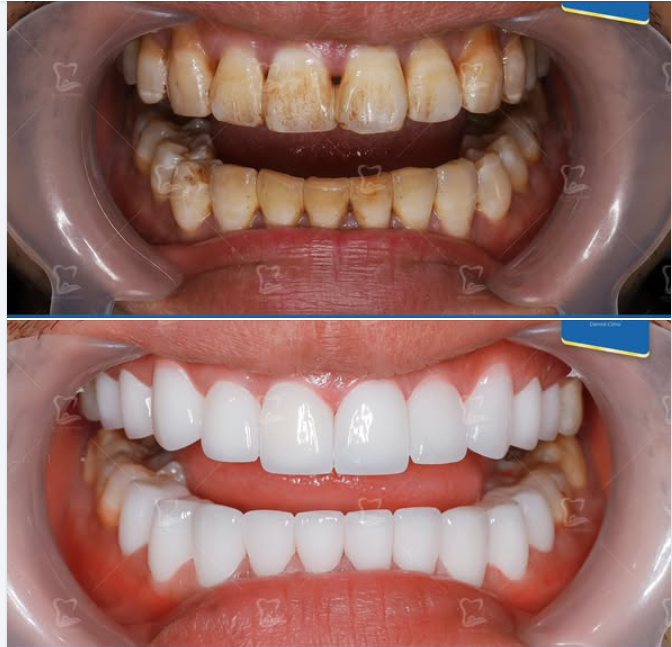 Khi làm sứ không chỉ để đẹp