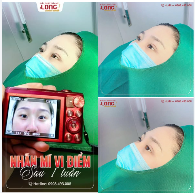Trả kết quả “Nhấn mí” của khách