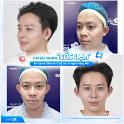 FLEX GÓC NGHIÊNG "SẮC LẸM: