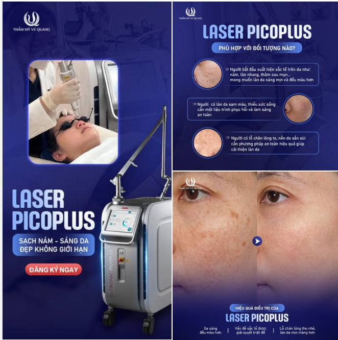 CHỈ ĐỊNH LASER PICOPLUS TỪ CHUYÊN GIA: KHI NÀO BẠN CẦN?