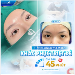 MÍ LÓT, NẾP MÍ MỜ NHẠT – KHẮC PHỤC CHỈ SAU 45 PHÚT