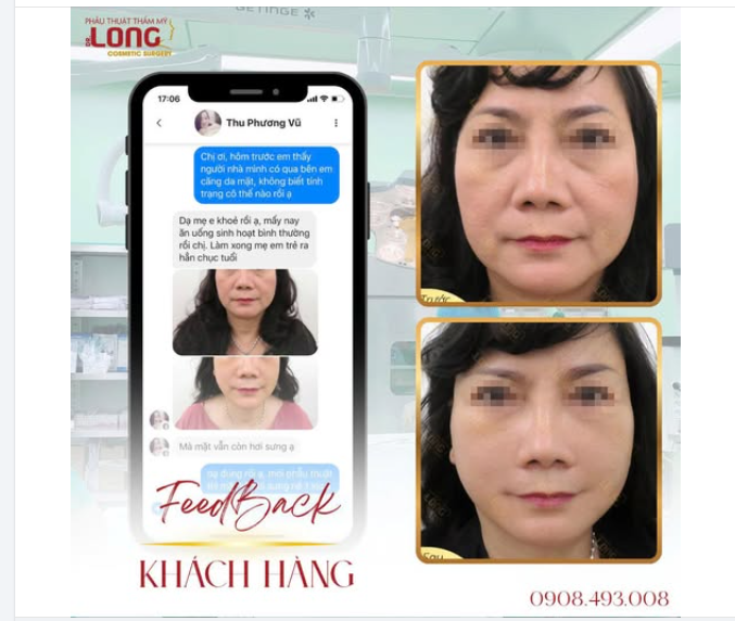 Góc FEEDBACK KHÁCH HÀNG
