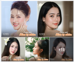 Gương mặt "đẹp lên" một cách nhẹ nhàng, hài hoà và vẫn giữ được nét riêng với dáng mũi Sline tự nhiên