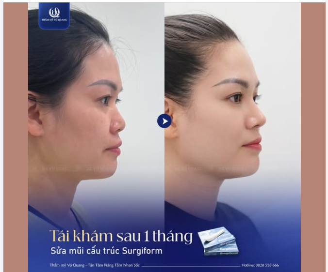 TÁI KHÁM SAU 1 THÁNG – DIỆN MẠO MỚI, TỰ TIN MỚI