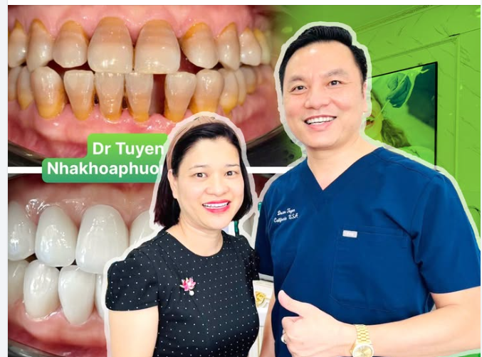 Bí quyết chọn màu răng sứ đẹp nhất