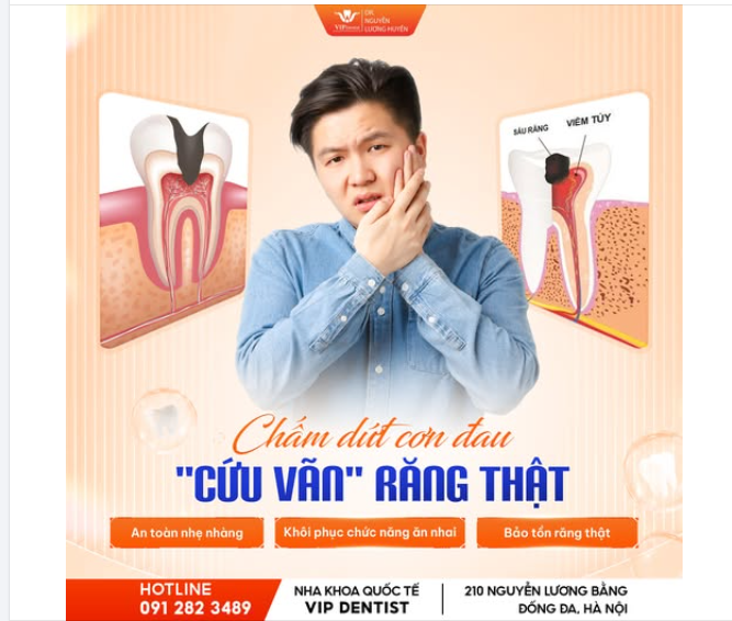 ĐỪNG ĐỂ SÂU RĂNG "ĂN MẤT" RĂNG THẬT – CHẤM DỨT CƠN ĐAU NGAY HÔM NAY!