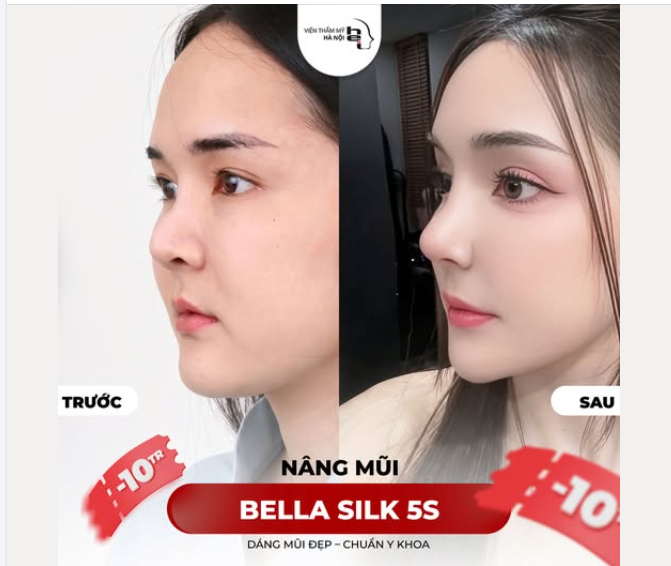 SỐNG MŨI THAY ĐỔI – VẬN MỆNH ĐỔI THAY? THỰC HƯ THẾ NÀO?