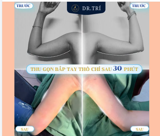 TẠM BIỆT BẮP TAY "LỰC ĐIỀN" – TỰ TIN DIỆN ĐẦM HAI DÂY CHỈ SAU 30 PHÚT!