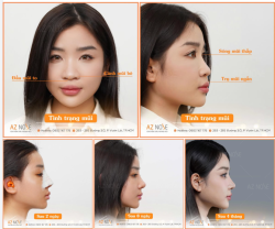 Top 20 Miss Grand Vietnam 2025 nâng cấp visual thành công sau 4 tháng.