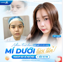 NHÌN TRẺ HƠN VÀI TUỔI CHỈ NHỜ VÙNG MÍ DƯỚI TƯƠI TẮN!