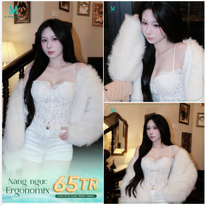 ƯU ĐÃI THÁNG 6 – NÂNG NGỰC ERGO CHỈ 65 TRIỆU