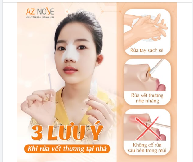 Chăm sóc đúng sau nâng mũi là một phần quan trọng quyết định quá trình hồi phục.