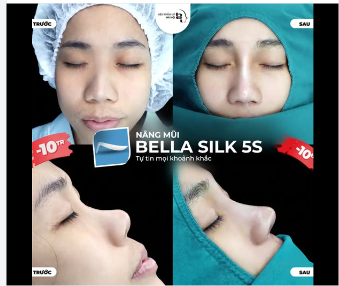 PHÁT HIỆN HỘI CHỊ EM XINH LÊN THẦN TỐC CHỈ SAU 45 PHÚT!