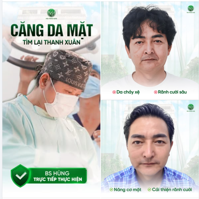 Căng da mặt nam giới - 60P lấy lại phong độ!