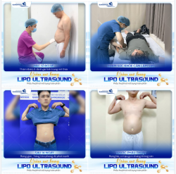 TỪ BỤNG BIA ĐẾN PHONG ĐỘ PHÁI MẠNH