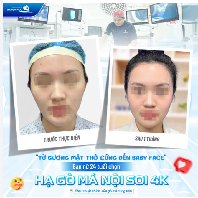 TỪ GƯƠNG MẶT THÔ CỨNG ĐẾN BABY FACE