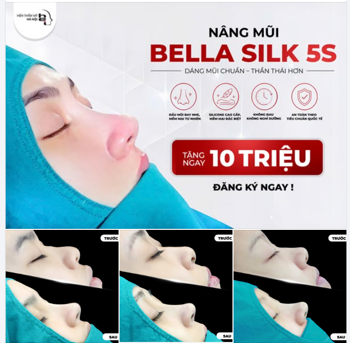 NÂNG MŨI BELLA SILK - MŨI ĐẸP TỰ NHIÊN