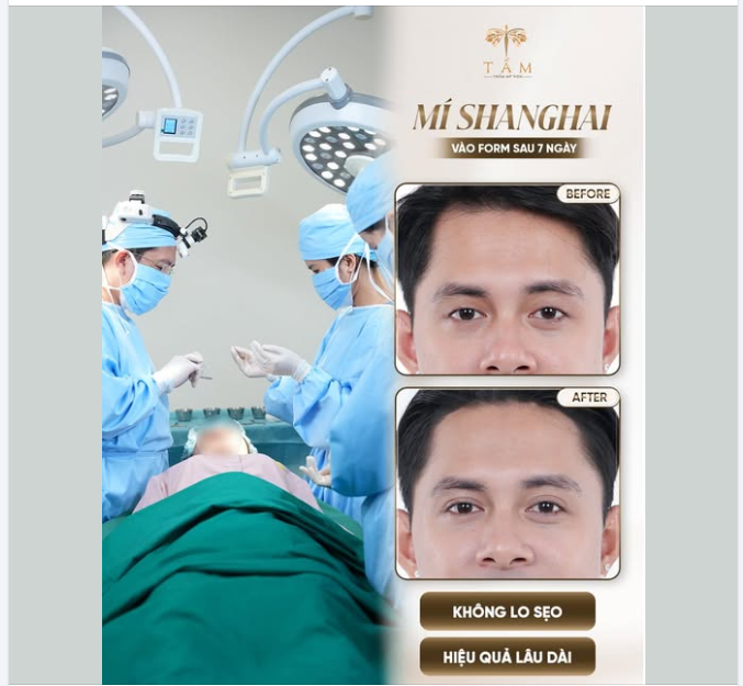 Nhiều cánh mày râu vẫn e ngại việc "đụng chạm dao kéo" vùng mắt vì sợ mất đi vẻ gai góc, nam tính vốn có, hoặc sợ bị... điệu.