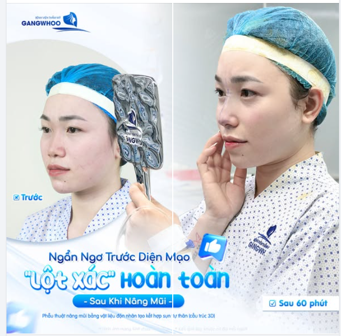 Ai cũng xứng đáng có một khoảnh khắc "Wow" hạnh phúc như thế! Gửi ngay ảnh hiện tại để bác sĩ giúp bạn tỏa sáng nhé!